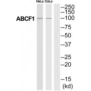 ATP Binding Cassette Subfamily F Member 1 (ABCF1) Antibody