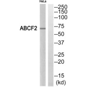 Western blot analysis of extracts from HeLa cells, using ABCF2 antibody.