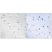 Immunohistochemistry analysis of paraffin-embedded human brain tissue using DDX3Y antibody.