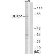 Western blot analysis of extracts from HepG2 cells, using DDX51 antibody.