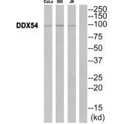 Western blot analysis of extracts from CoLo cells, 293 cells and JurKat cells, using DDX54 antibody.