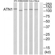 Western blot analysis of extracts from HeLa cells, A549 cells, K562 cells, COLO205 cells and NIH-3T3 cells, using ATN1 antibody.