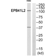 Erythrocyte Membrane Protein Band 4.1 Like 2 (EPB41L2) Antibody