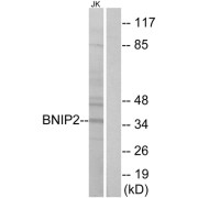 Western blot analysis of extracts from Jurkat cells, using BNIP2 antibody.