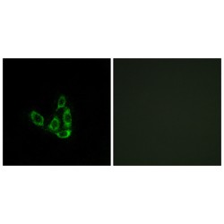 Beta-1,3-Galactosyl-O-Glycosyl-Glycoprotein Beta-1,6-N-Acetylglucosaminyltransferase 3 (GCNT3) Antibody