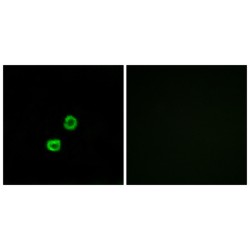 Beta-1,3-Galactosyl-O-Glycosyl-Glycoprotein Beta-1,6-N-Acetylglucosaminyltransferase 7 (GCNT7) Antibody