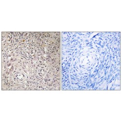 Beta-1,3-Galactosyl-O-Glycosyl-Glycoprotein Beta-1,6-N-Acetylglucosaminyltransferase 7 (GCNT7) Antibody