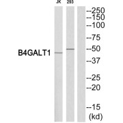 Beta-1,4-Galactosyltransferase 1 (B4GALT1) Antibody