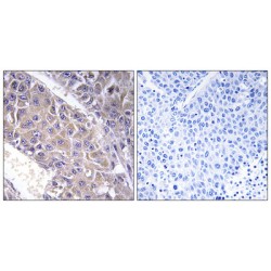 Beta-1,4-Galactosyltransferase 3 (B4GALT3) Antibody