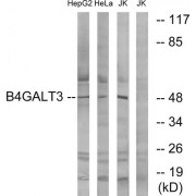 Western blot analysis of extracts from HepG2 cells, HeLa cells and Jurkat cells, using B4GALT3 antibody.