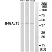 Western blot analysis of extracts from HeLa cells, HuvEc cells and 293 cells, using B4GALT5 antibody.