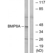 Western blot analysis of extracts from COLO cells, using BMP8A antibody.