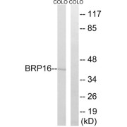 Western blot analysis of extracts from COLO cells, using BRP16 antibody. The lane on the right is treated with antigen-specific peptide.