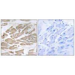 Brain Protein 44 Like Protein (BRP44L) Antibody