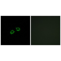 ADP Ribosylation Factor Guanine Nucleotide Exchange Factor 2 (ARFGEF2) Antibody