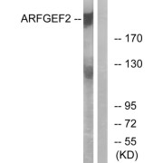 abx014281