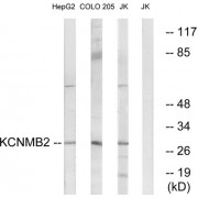 Western blot analysis of extracts from HepG2 cells, COLO cells and Jurkat cells, using KCNMB2 antibody.