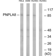 Western blot analysis of extracts from HeLa cells, A549 cells and HUVEC cells, using PNPLA8 antibody.