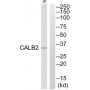 Western blot analysis of extracts from Jurkat cells, using CALB2 antibody.