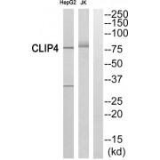 Western blot analysis of extracts from HepG2 cells and Jurkat cells, using CLIP4antibody.