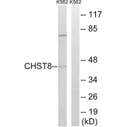 Western blot analysis of extracts from K562 cells, using CHST8 antibody.