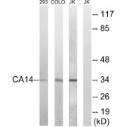 Western blot analysis of extracts from 293 cells, COLO cells,and Jurkat cells, using CA14 antibody.