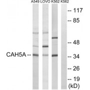 Western blot analysis of extracts from A549 cells, LOVO cells and K562 cells, using CA5A antibody.