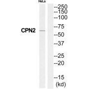 Western blot analysis of extracts from HeLa cells, using CPN2 antibody.