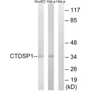 Western blot analysis of extracts from HUVEC cells and HeLa cells, using CTDSP1 antibody.