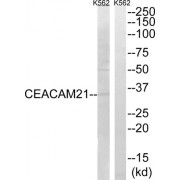 Western blot analysis of extracts from K562 cells, using CEACAM21 antibody.