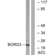 Western blot analysis of extracts from Jurkat cells, using BORG3 antibody.