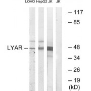 Western blot analysis of extracts from LOVO cells, HepG2 cells and Jurkat cells, using LYAR antibody.