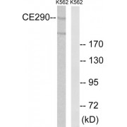 Western blot analysis of extracts from K562 cells, using CEP290 antibody.