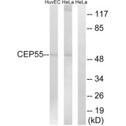 Western blot analysis of extracts from HUVEC cells and HeLa cells, using CEP55 antibody.