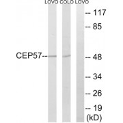 Western blot analysis of extracts from LOVO cells and COLO cells, using MRPS7 antibody.