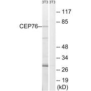 Western blot analysis of extracts from 3T3 cells, using CEP76 antibody.