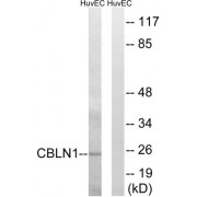 Western blot analysis of extracts from HUVEC cells, using CBLN1 antibody.