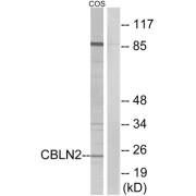 Western blot analysis of extracts from COS cells, using CBLN2 antibody.