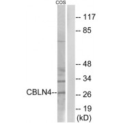 Western blot analysis of extracts from COS cells, using CBLN4 antibody.