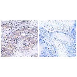 Ceroid-Lipofuscinosis Neuronal Protein 6 (CLN6) Antibody