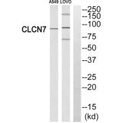 Western blot analysis of extracts from A549 cells and LOVO cells, using CLCN7 antibody.