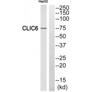 Western blot analysis of extracts from HepG2 cells, using CLIC6 antibody.