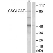 Western blot analysis of extracts from Jurkat cells, using CSGLCAT antibody.