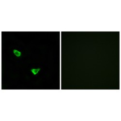 Chondroitin Sulfate Synthase 2 (CHSY2) Antibody