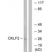 Western blot analysis of extracts from K562 cells, using CKLF2 antibody.
