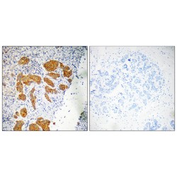 Chemokine-Like Factor Superfamily Member 4 (CKLF4) Antibody