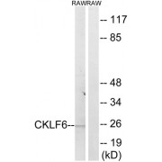 Western blot analysis of extracts from RAW264.7 cells, using CKLF6 antibody.