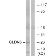 Western blot analysis of extracts from Jurkat cells, using CLDN6 antibody.