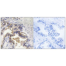 Beta-Galactoside Alpha-2,6-Sialyltransferase 1 (ST6GAL1) Antibody