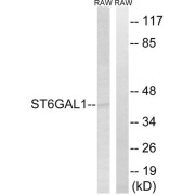 Western blot analysis of extracts from RAW264.7 cells, using ST6GAL1 antibody.